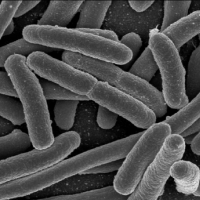 microbes under electron scanning microscope