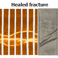 healed fracture