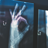 X-ray of a hand making an A-Ok sign